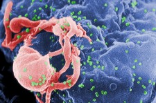 21. ops. HIV Virus. Wikimedia