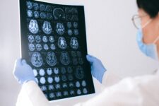 News_Neuroscience 1_Courtesy of Pexels