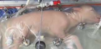 Artificial wombs deserve more research and investment